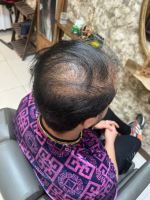 پروتز مو طبیعی بدون چسب