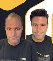 مدرس پروتز مو آرش دهقان