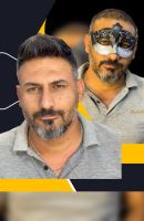 پروتز مو در شهرکرد