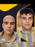 پروتز مو در شهرکرد