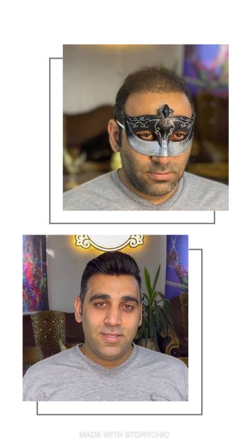 آموزش و پروتز مو در مبارکه 