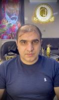 مدرس و متخصص پروتز مو آرش دهقان