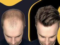 مدرس و متخصص پروتز مو آرش دهقان