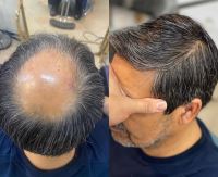 متخصص و مدرس پروتز مو سپاهان شهر