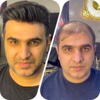 متخصص و مدرس پروتز مو سپاهان شهر