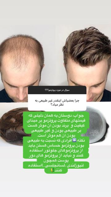 آموزش و متخصص پروتز مو در شهرضا 