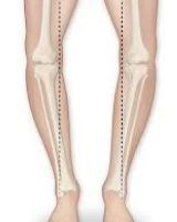 کفی طبی پای صاف