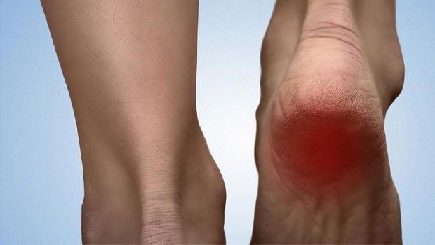 کفی طبی پای صاف