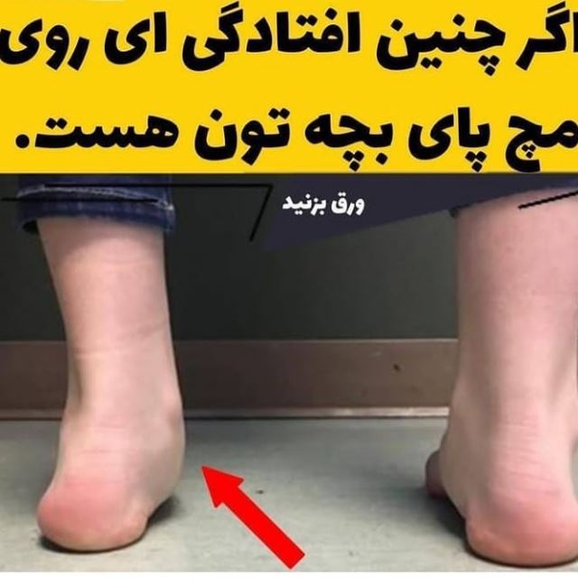 کفی طبی پای صاف