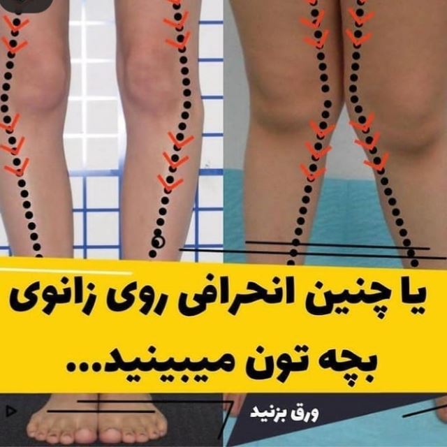 کفی طبی پای صاف