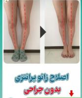 کفی طبی پای صاف