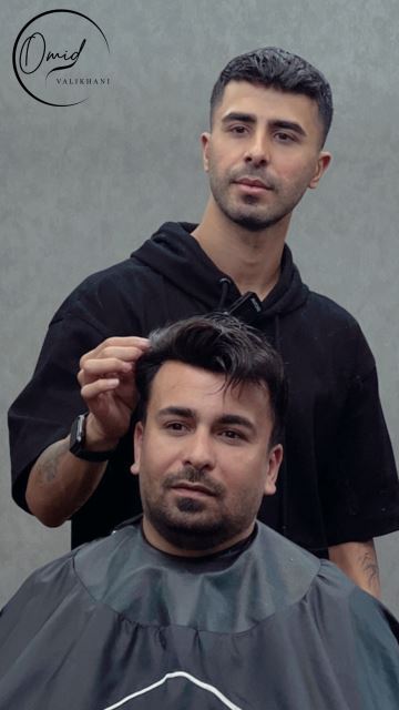 پروتز مو در بروجن