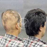 ترمیم مو بهارستان