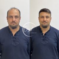 ترمیم مو بهارستان