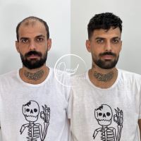 پروتز مو بهارستان