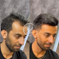 ترمیم مو در شاهین شهر