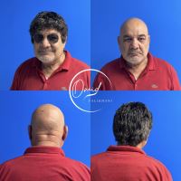 ترمیم مو در شاهین شهر