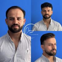 ترمیم مو در شاهین شهر