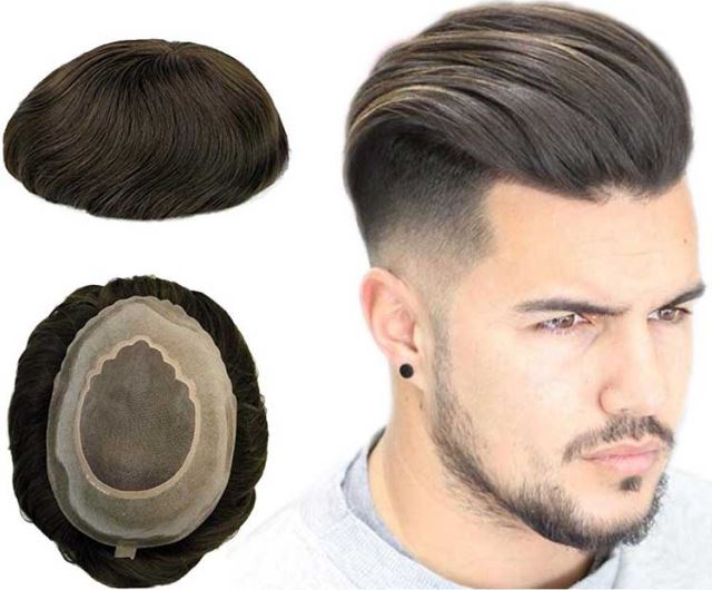 پروتز و ترمیم مو