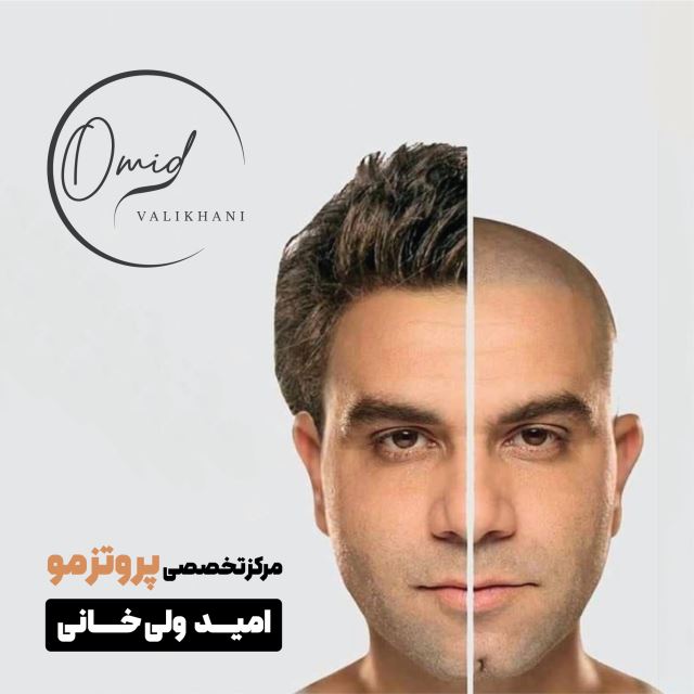 پروتز مو زرین شهر