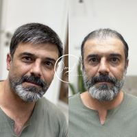 ترمیم مو زرین شهر