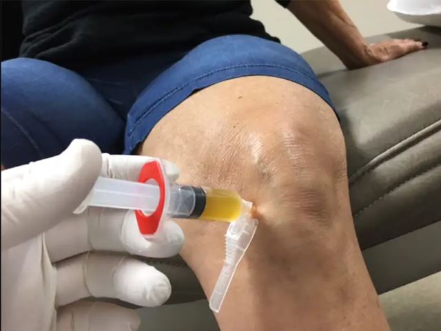 بهترین مرکز لاغری شهریار