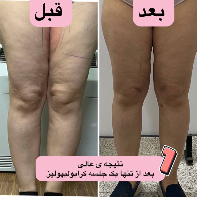 بهترین کلینیک لاغری در اصفهان 