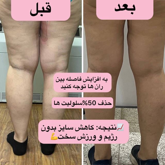 بهترین کلینیک لاغری در اصفهان 