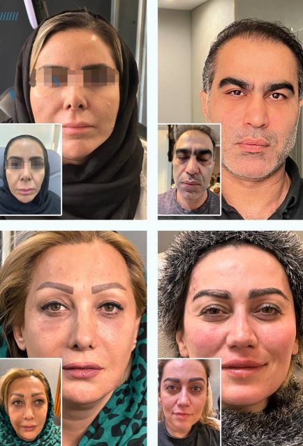 پروفایلو استراکچرا