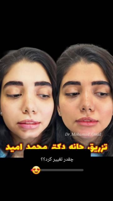 پروفایلو استراکچرا