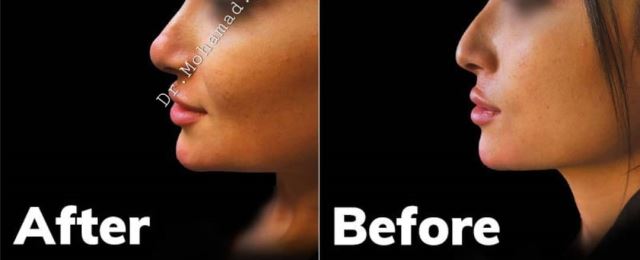 پروفایلو استراکچرا