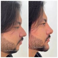 پروفایلو استراکچرا