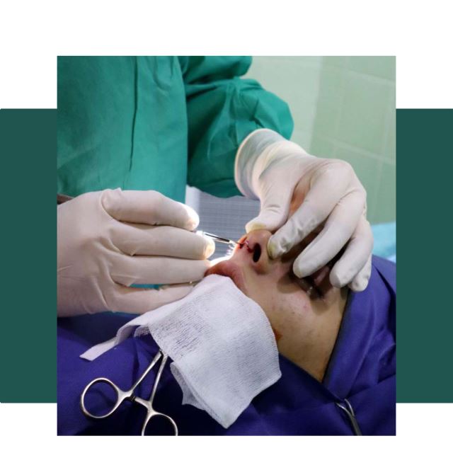 جراح و متخصص گوش و حلق و بینی اصفهان