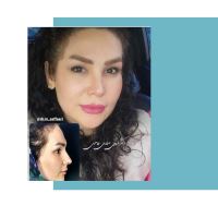 جراح و متخصص گوش و حلق و بینی اصفهان