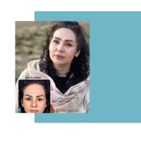 جراح و متخصص گوش و حلق و بینی اصفهان