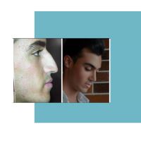 جراح و متخصص گوش و حلق و بینی اصفهان