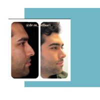 جراح و متخصص گوش و حلق و بینی اصفهان