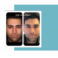 جراح و متخصص گوش و حلق و بینی اصفهان