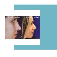 جراح و متخصص گوش و حلق و بینی اصفهان