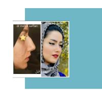 جراح و متخصص گوش و حلق و بینی اصفهان