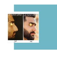 جراح و متخصص گوش و حلق و بینی اصفهان