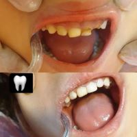 خدمات تخصصی دندانپزشکی اطفال در شرق تهران