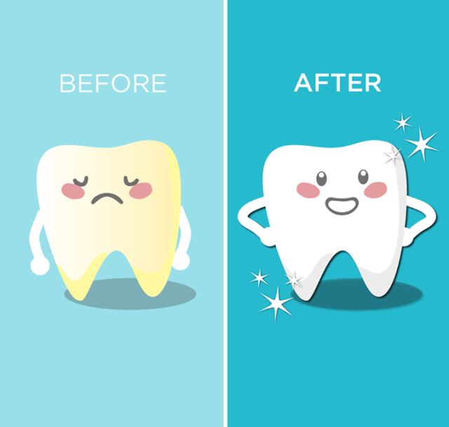 کامپوزیت اقساطی در تهران 