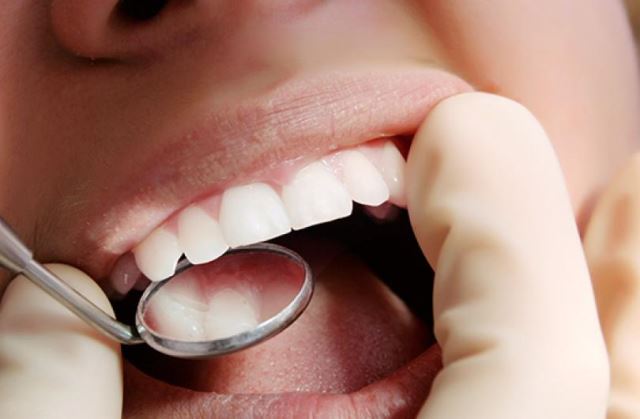 کامپوزیت اقساطی در تهران 