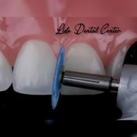 بهترین مرکز ایمپلنت تهران