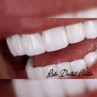 بهترین مرکز ایمپلنت تهران