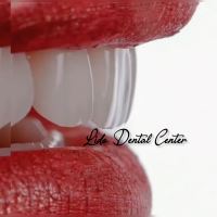 بهترین مرکز ایمپلنت تهران