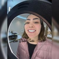 بهترین مرکز ایمپلنت تهران