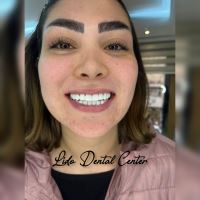 بهترین مرکز ایمپلنت تهران