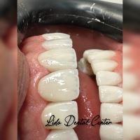 بهترین مرکز ایمپلنت تهران